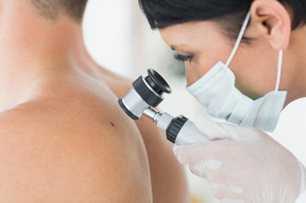 Câncer de pele: cirurgião plástico explica os tipos mais comuns e orienta sobre prevenção