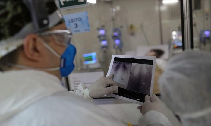 Covid-19 é classificada também como doença vascular e pode provocar trombose