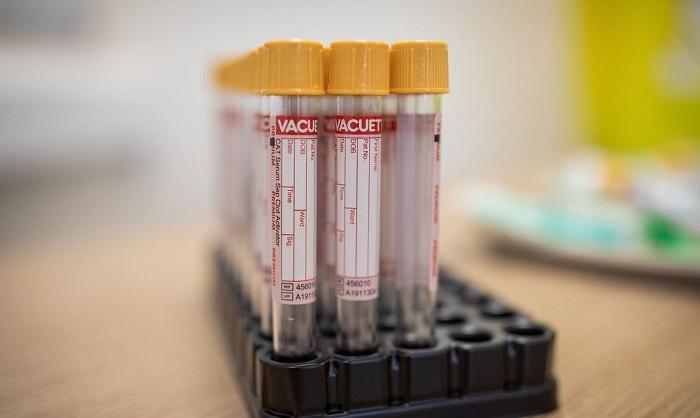 Covid-19: Pfizer e BioNTech pedem uso emergencial de vacina na Europa