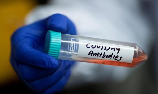 Covid-19: Brasil tem 11,7 milhões de casos e 285,1 mil mortes