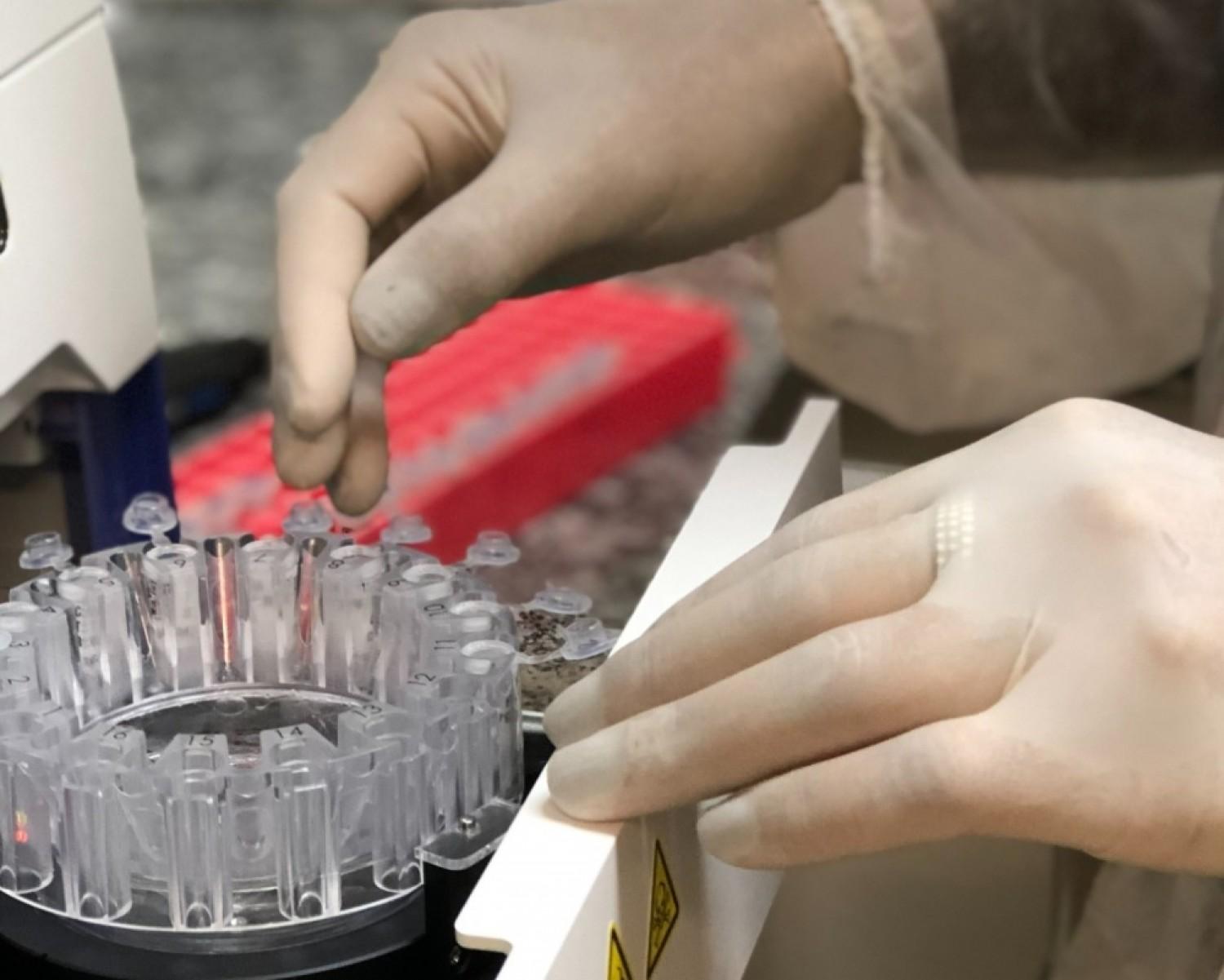 Vírus abundante na espécie humana pode servir de biomarcador para a COVID-19