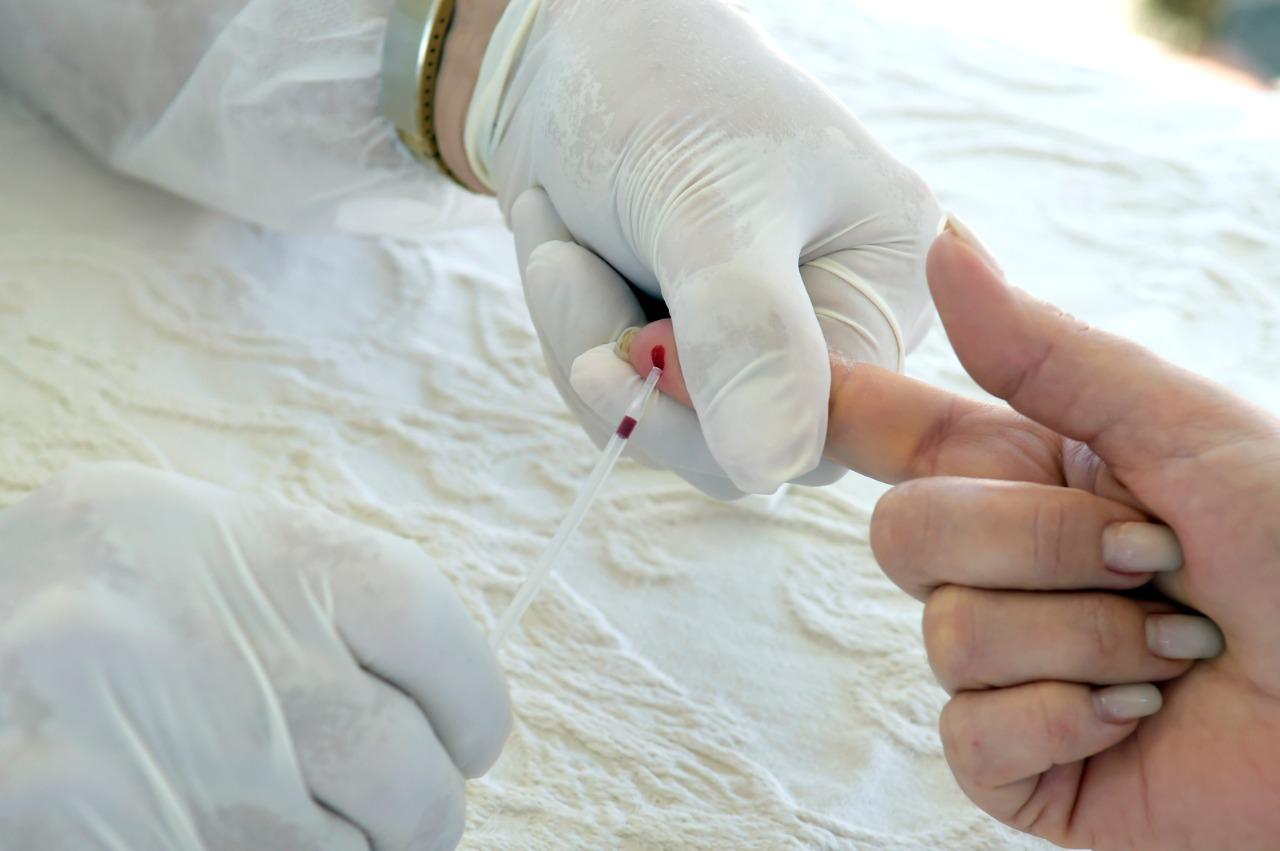 Testes rápidos para Covid-19 começam a ser aplicados nas UBSs