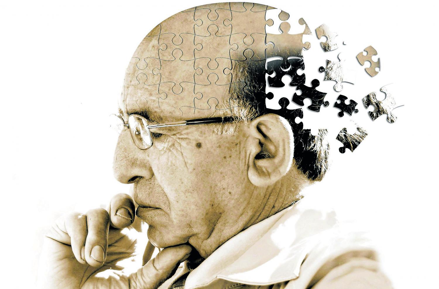 Como lidar com quem tem a Doença de Alzheimer?